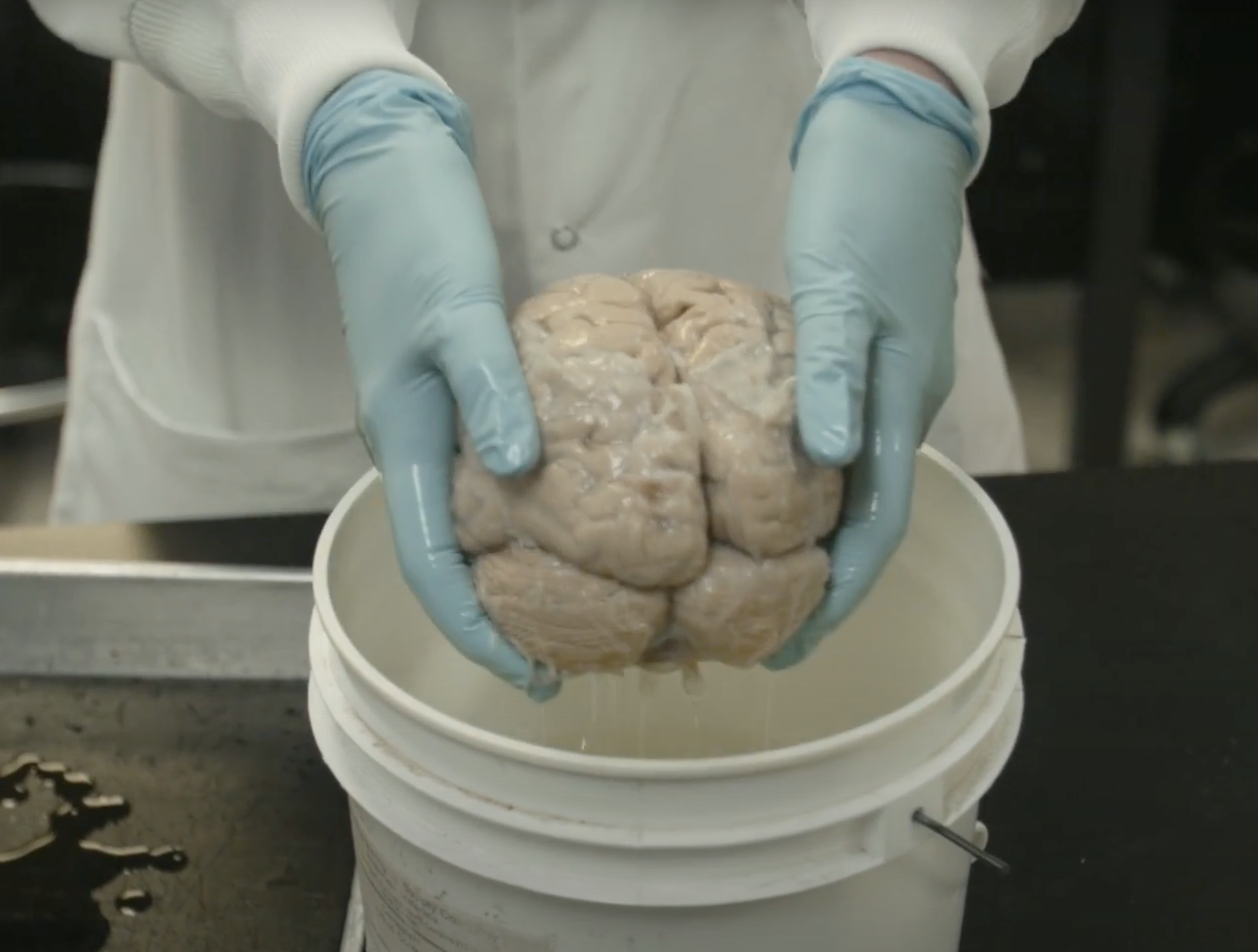 A person wearing blue gloves holds a human brain above a white plastic bucket in a laboratory setting.